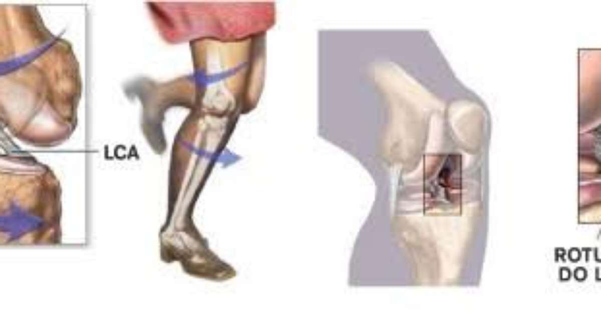 
Ruptura do LCA e problema no menisco: entenda lesões e veja quanto tempo Dudu deve desfalcar o Palmeiras
