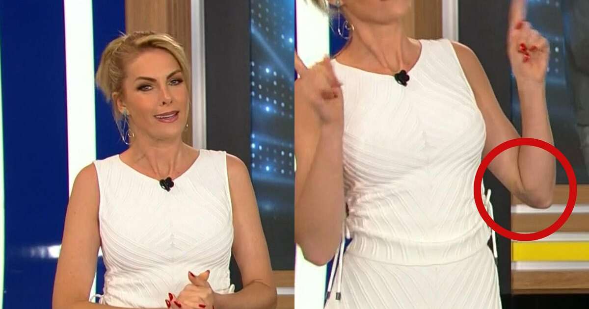 Ana Hickmann Apresenta Programa Com Roupa Que Deixou Hematoma No Bra O