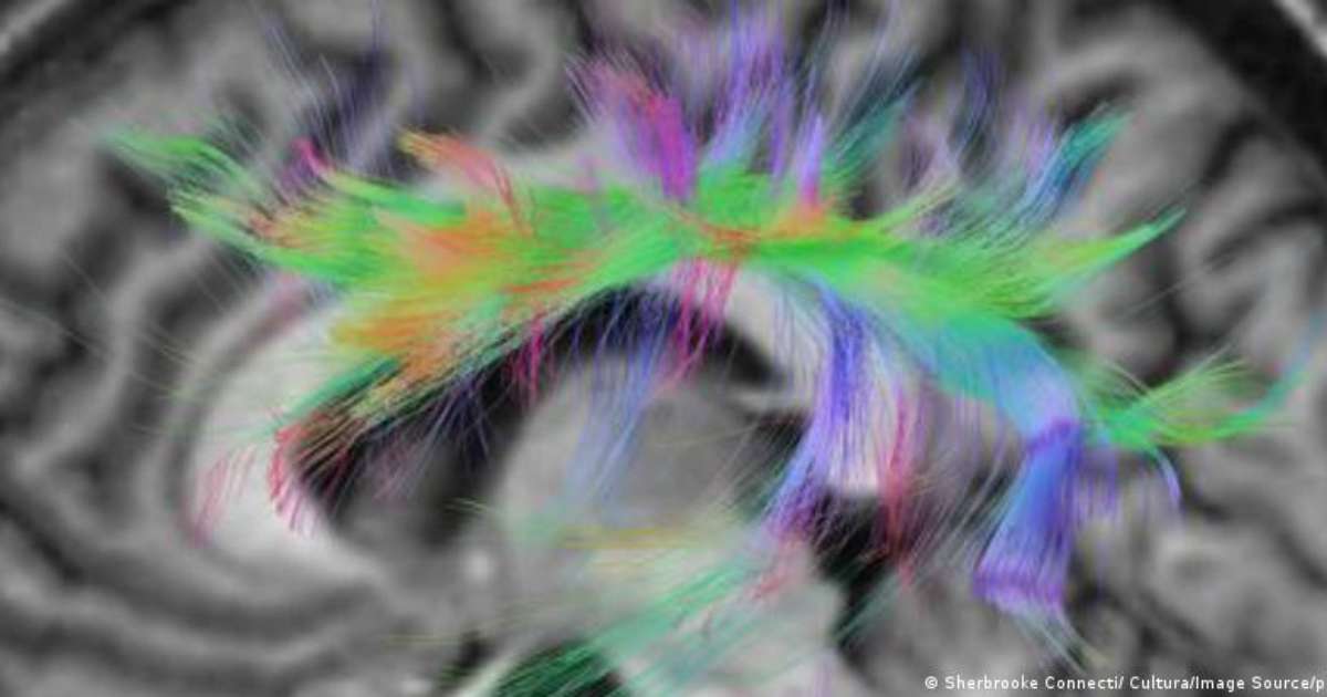 Forscher entdecken den Ursprung des Stotterns im Gehirn