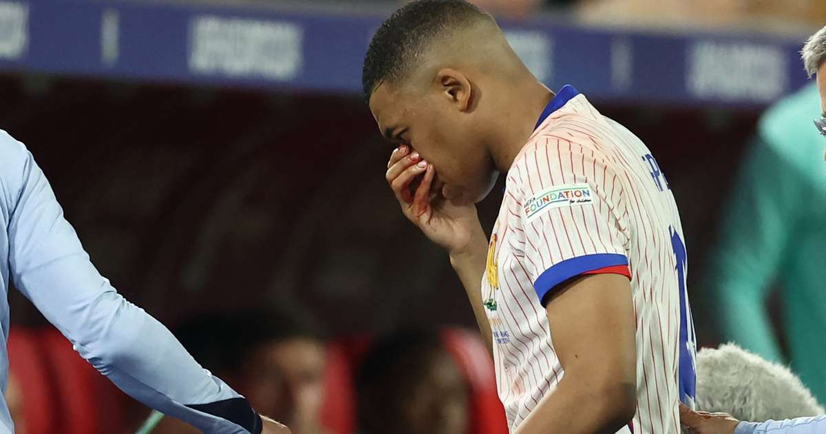 Mbappé manquera la France aux Championnats d’Europe à cause d’un nez cassé