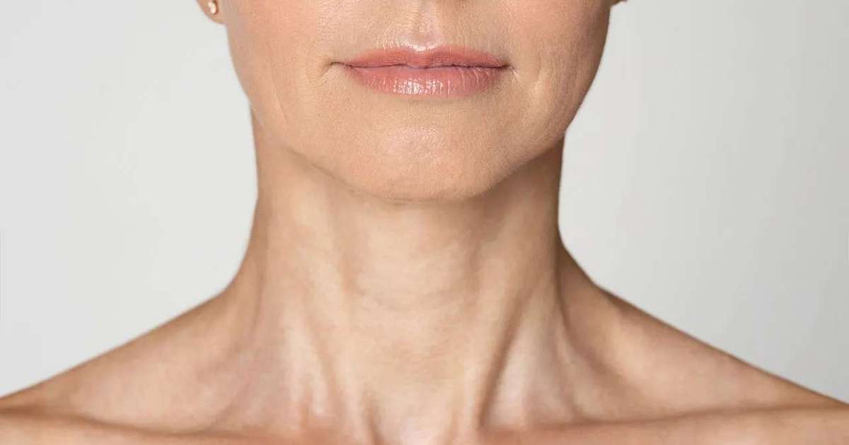 Rir pode causar rugas? Descubra a verdade sobre as marcas de expressão facial