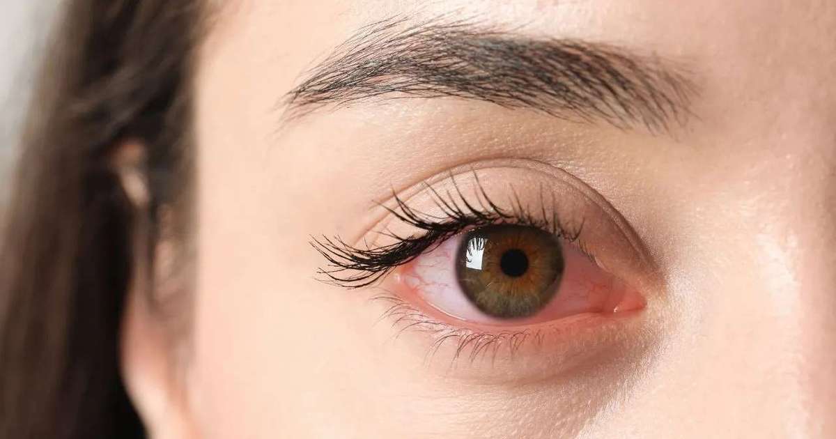 Outono: Como Proteger a Saúde Ocular Nesta Estação