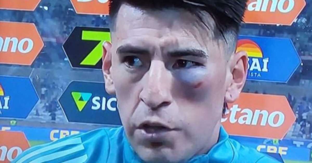 Villalba continua partida pelo Cruzeiro mesmo com olho inchado e roxo.