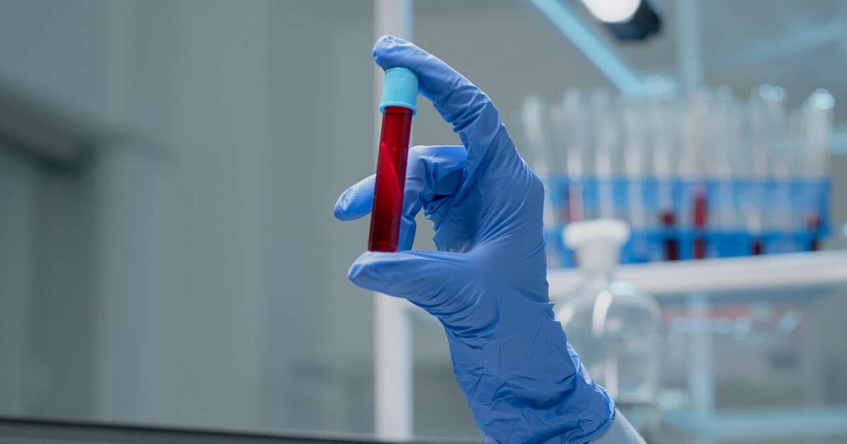 Hemofilia: mitos sobre doença que afeta coagulação do sangue