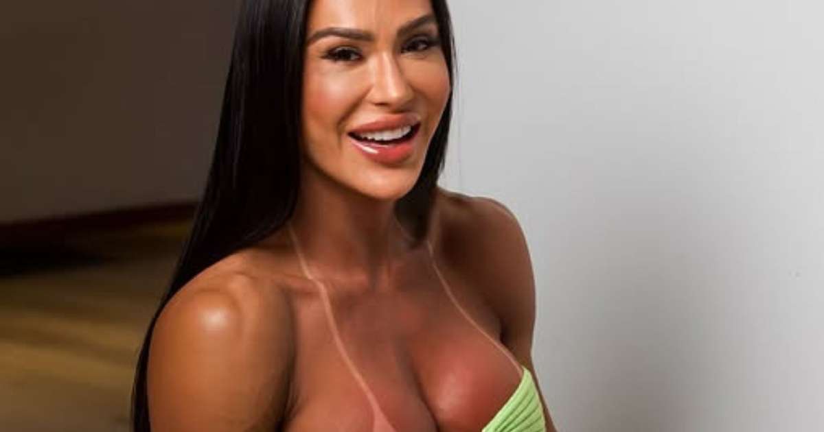 Após lesão grave no joelho, Gracyanne Barbosa deixa o 'Dança dos Famosos' e passa por cirurgia