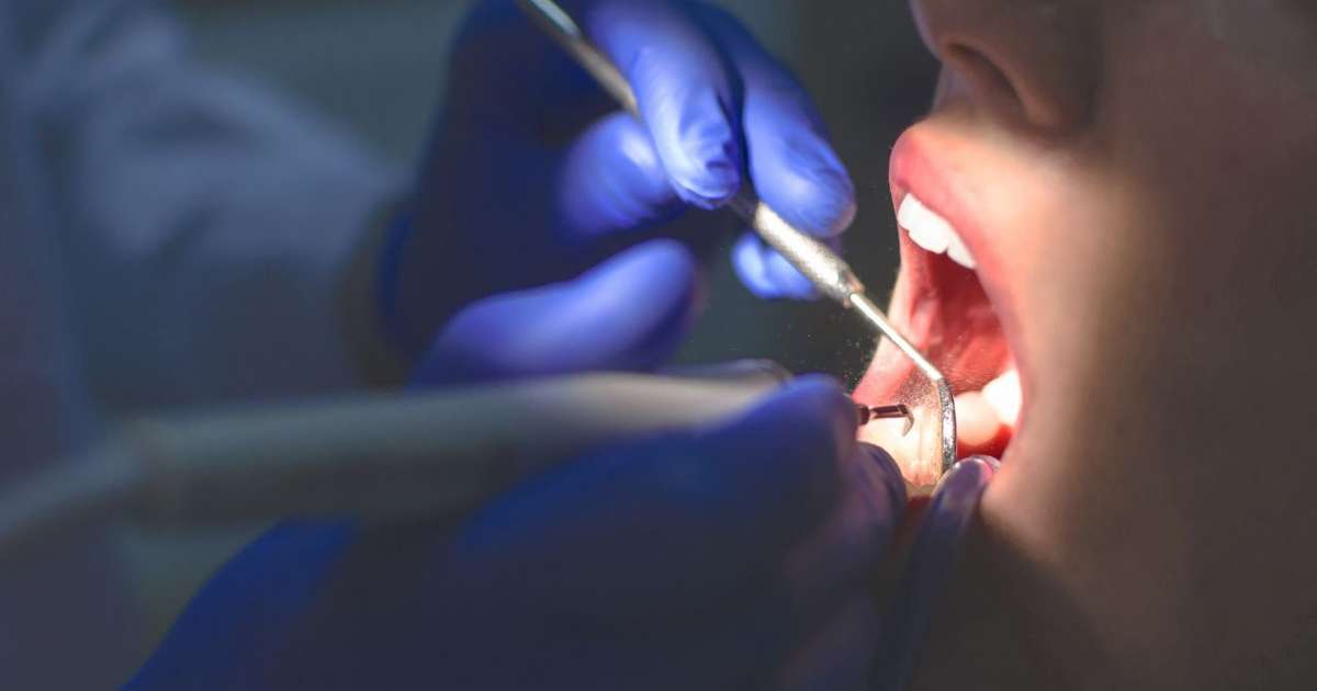 Quebrou um dente? Confira passo a passo do que fazer