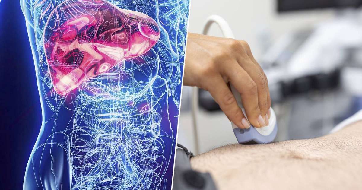 Epidemia "silenciosa" do fígado: temos um problema que escapa exames e que a ciência tenta deter