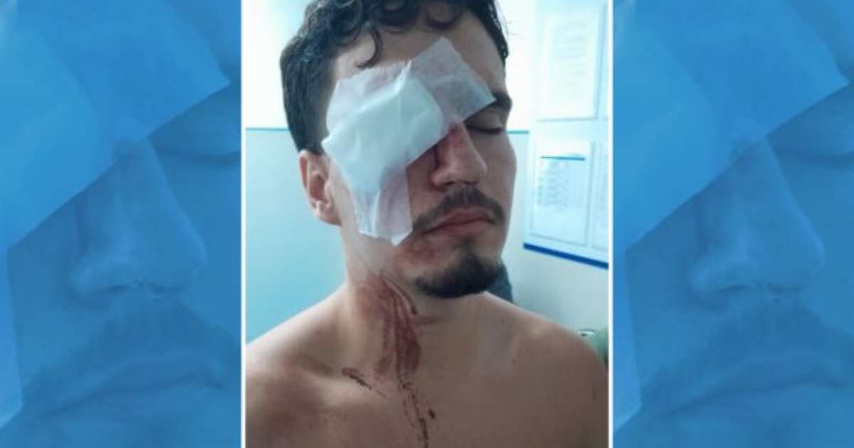 Estudante perde visão em ação policial após Flamengo x Vasco; mãe relata caso