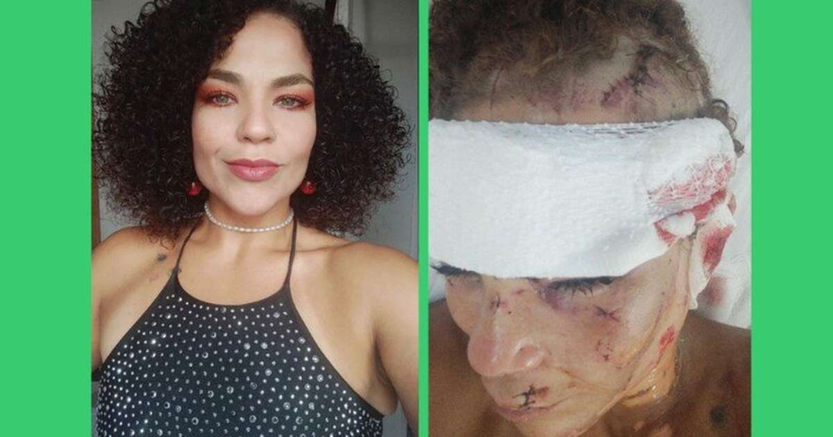Mulher sobrevive a tentativa de feminicídio e mobiliza campanha para ...