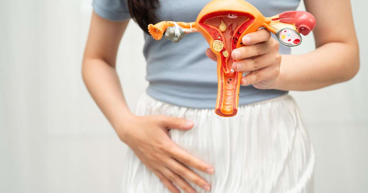 Estilo de vida e dieta podem reduzir sintomas de endometriose