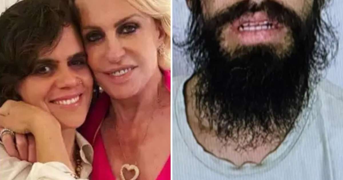 Ex-genro de Ana Maria Braga é preso e aparece com marcas de agressão