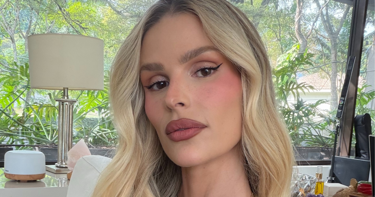 Yasmin Brunet mostra hematomas nas pernas causados pelo lipedema