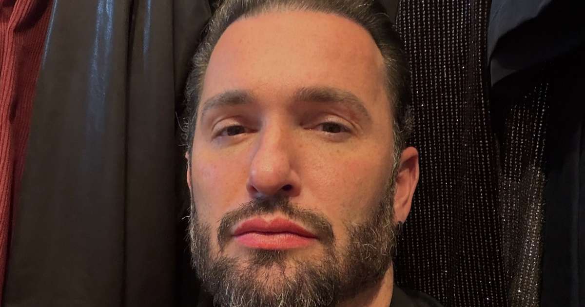 Diego Hypolito impressiona ao revelar antes e depois de mudanças no rosto: 'Meu Deus'; veja