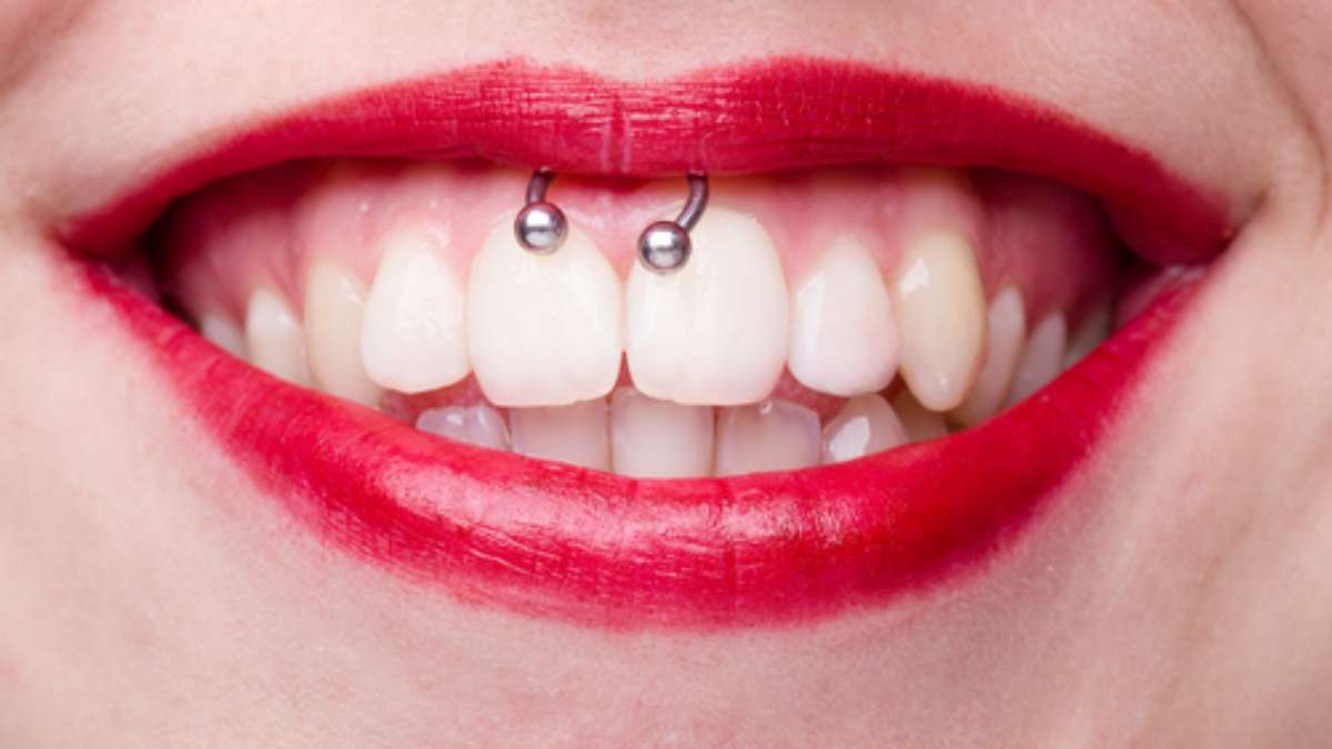 O piercing na boca inflamou: o que fazer?
