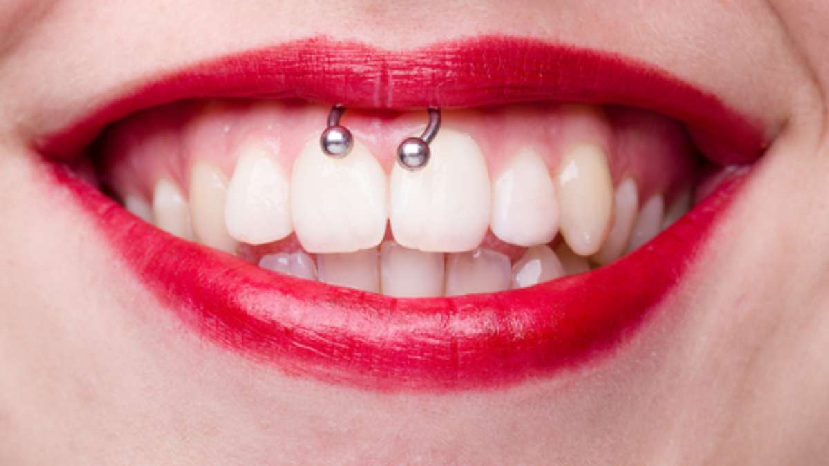 Bem Estar, Piercings na boca exigem cuidado especial