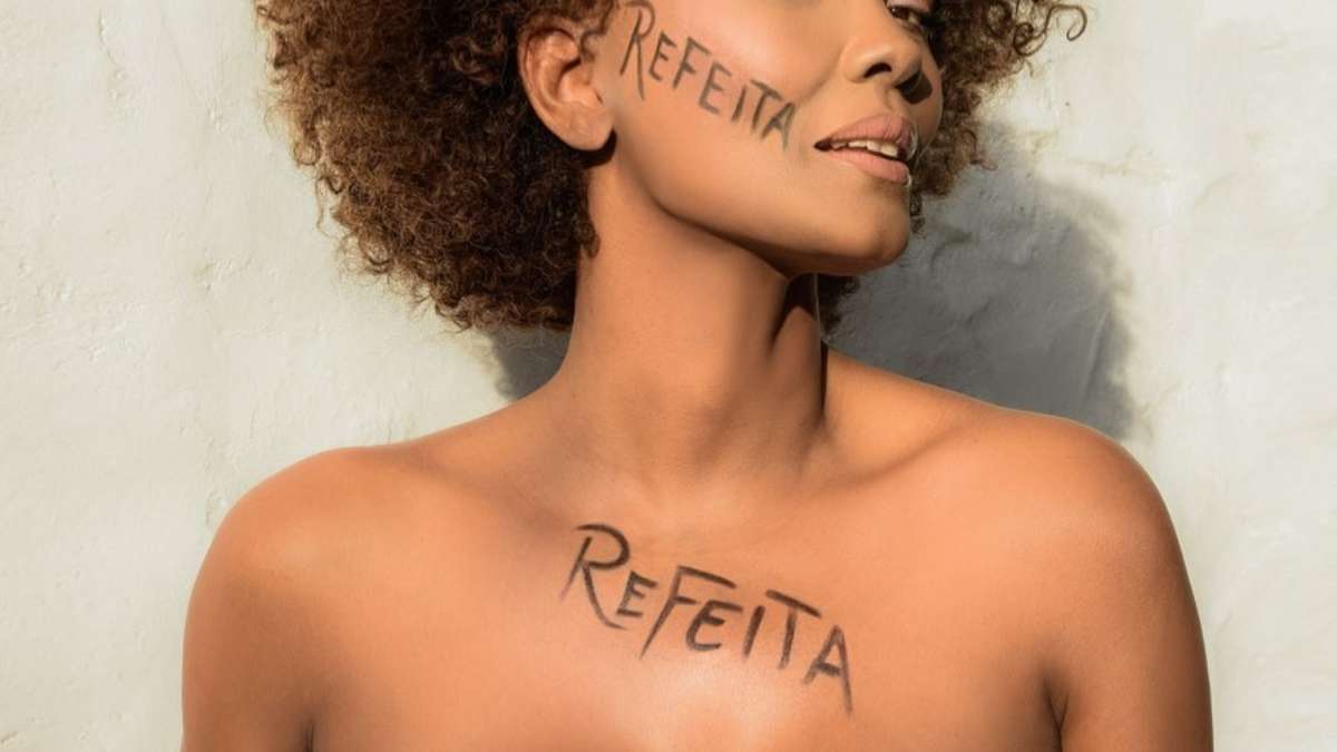 Isabel Fillardis comemora superação de doença dermatológica rara