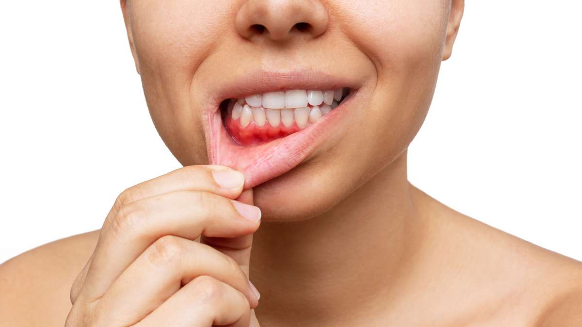 Além da estética: entenda por que o tratamento ortodôntico faz bem também  para a saúde bucal, Colgate