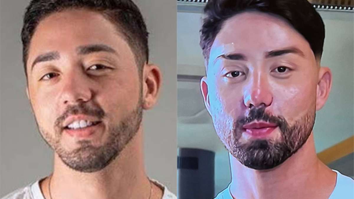 Rico Melquiades reveals his new appearance after plastic surgery