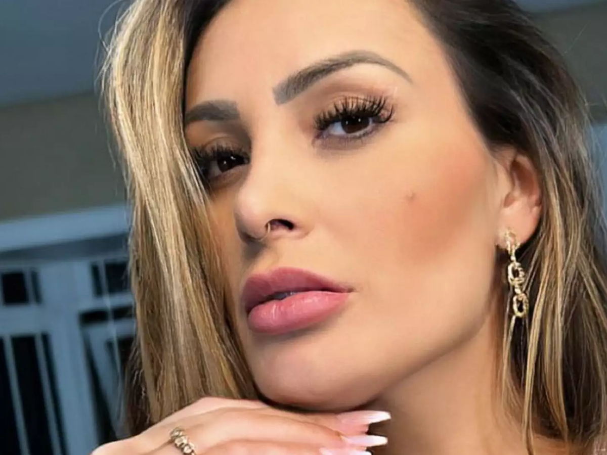 Andressa Urach passa por 3 cirurgias estéticas e revela estado de saúde