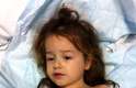 Amelia Lancaster sofre por causa de uma meningite em um hospital de Oxford, no Reino Unido. A menina surpreendeu médicos após se recuperar quando os médicos davam horas de vida para ela