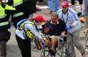 15 de abril - Vítima das explosões em Boston recebe atendimento médico em hospital