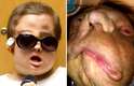 Uma polonesa de 26 anos que teve a face desfigurada por um tumor facial revelou seu novo rosto durante uma coletiva de imprensa, nesta quinta-feira, 20. A moça, identificada apenas como Joanna, é a segunda paciente a receber um transplante de face na Polônia, segundo o jornal Daily Mail