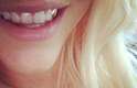 Esse sorriso com dente de ouro é de Ke$ha