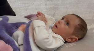Bebê de Gaza é enviada de volta à zona de guerra após cirurgia no coração
