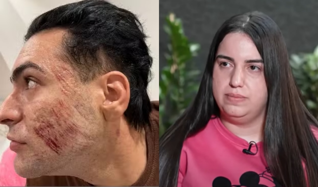 Natalia Becker (à dir.) teria feito cortes na pele do rosto de Henrique Chagas (à esq.), que morreu após passar pelo procedimento de peeling de fenol