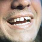 Prefeitura cuida do sorriso do povo em busca do 1º emprego