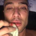 Youtuber apanha de PMs em SP e tudo indica que foi homofobia