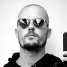 Paulinho Vilhena passa por procedimento de implante capilar