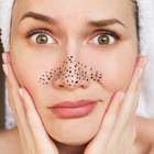 Como tirar cravos do nariz em casa sem acabar com sua pele