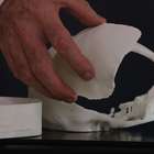 Brasileiros desenvolvem tecnologia de reconstrução ...