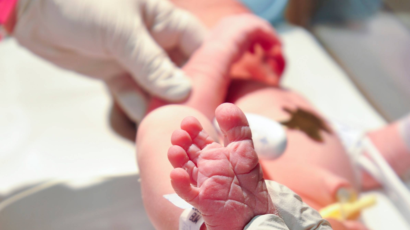 Teste do pezinho  Foto: iStock