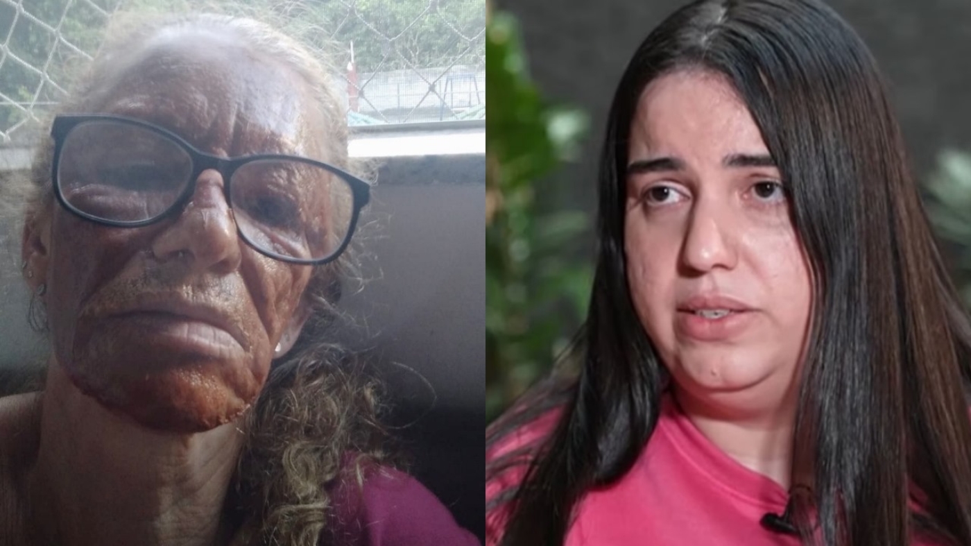 Magali fez peeling de fenol na clínica de Natalia Becker no Rio de Janeiro  Foto: Acervo Pessoal/TV Record