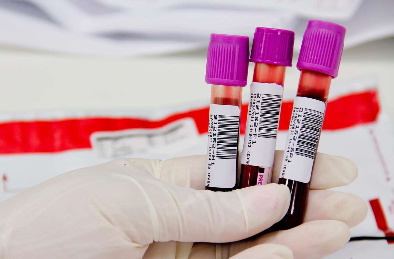 Exame de sangue pode antecipar diagnóstico e melhorar prognóstico de câncer