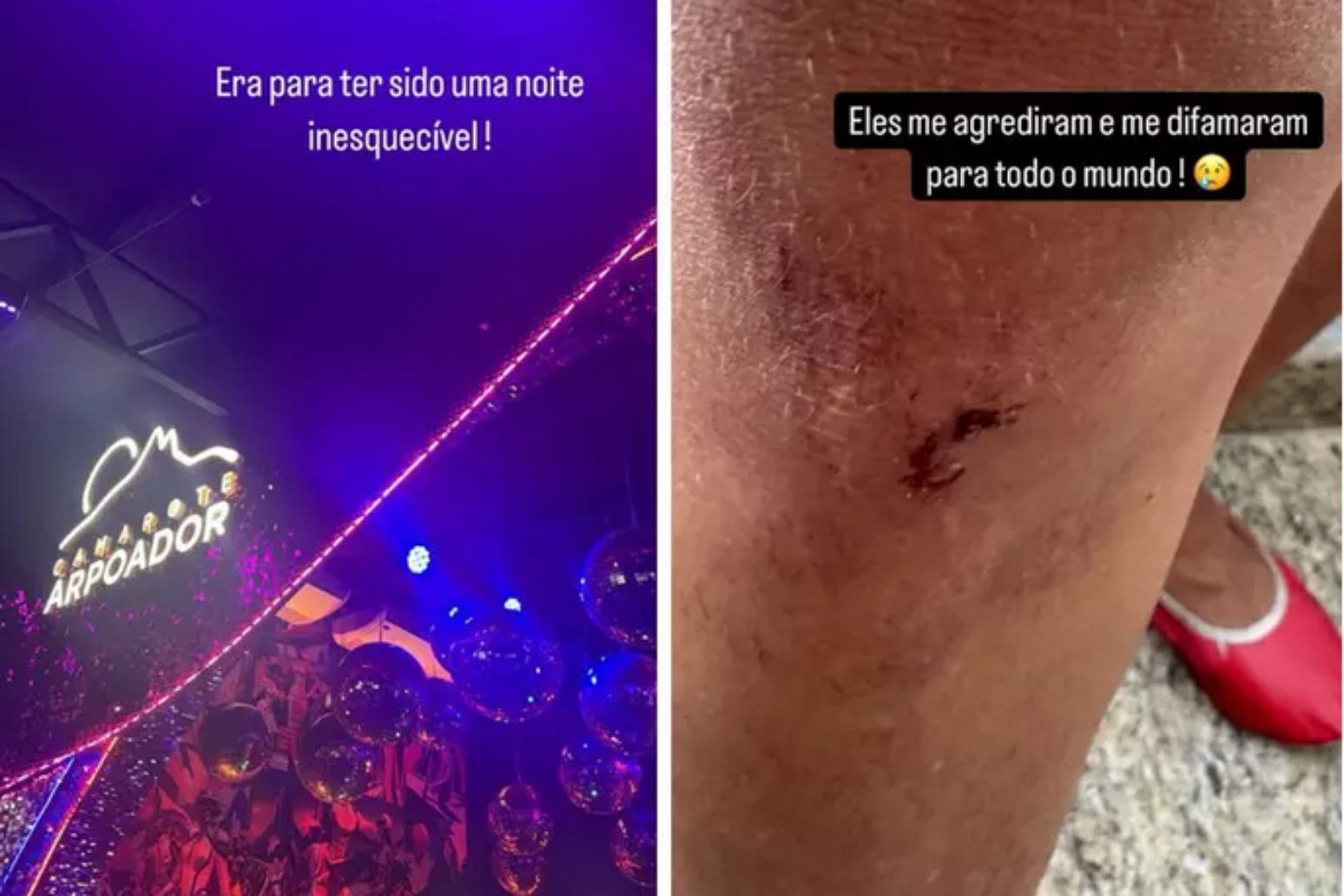 Mulher acusada de morder pessoas na Sapucaí desabafa: 'Legítima defesa'