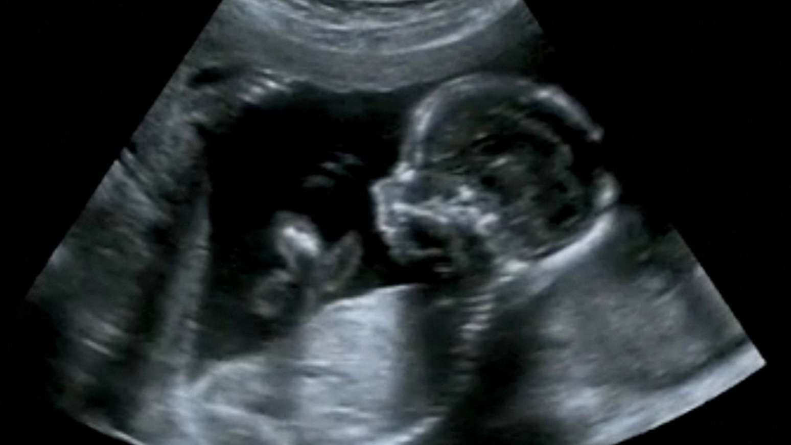 Descubra tudo o que um bebê pode fazer dentro da barriga da mãe
