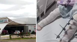 Mãe denuncia que filha teve perna errada operada na Paraíba