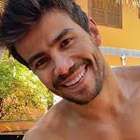 Veja procedimentos que mudaram sorriso do cantor Mariano