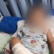 Bebê é internado com bronquiolite e precisa amputar o pé; família cita negligência