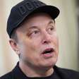 Musk aparece com olho roxo durante evento com Trump: 'Soco no rosto'