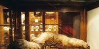 Entre as bizarrices encontradas no Mutter Museum estão crânios, dentes e até mesmo um intestino gigante  Foto: Divulgação