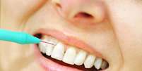 O fio dental e a escova interdental chegam a lugares que a escova não alcança e eliminam restos de alimento e bactérias que ficam entre os dentes.   Foto: Shutterstock