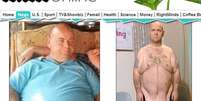 <p>Stephen Dockerill perdeu 82 kg com uma cirugia bariátrica, mas agora sofre com o excesso de pele de sua barriga</p>  Foto: Reprodução