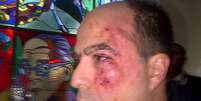 O deputado opositor Julio Borges apareceu com o rosto sangrando   Foto: PRIMERO JUSTICIA PRESS OFFICE / AFP