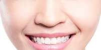 O resultado do clareamento dentário nem sempre fica só por conta do sorriso branco. A sensibilidade pode dar as caras no dia da aplicação.  Foto: Shutterstock