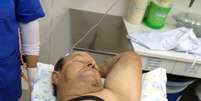 Homem fica com serra presa na barriga após se ferir durante corte de madeira  Foto: Assessoria do Hospital Vida e Saúde / Divulgação