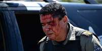 <p>Oito policiais ficaram feridos durante confronto com manifestantes em Fortaleza</p>  Foto: AFP